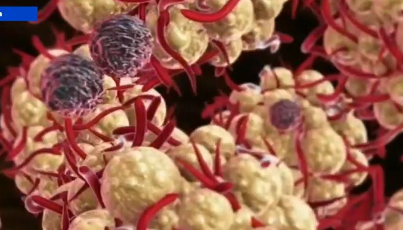 Ministerio de Salud indica situación de MPOX en el país