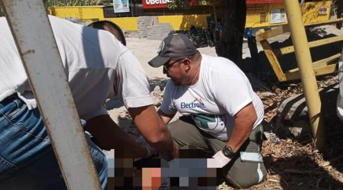 Accidentes de Tránsito, mujer resulta con amputación de pierna