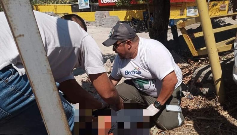 Una mujer resultó con amputación de pierna tras accidente Accidentes de Tránsito, mujer resulta con amputación de pierna