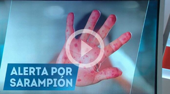 Alerta por sarampión