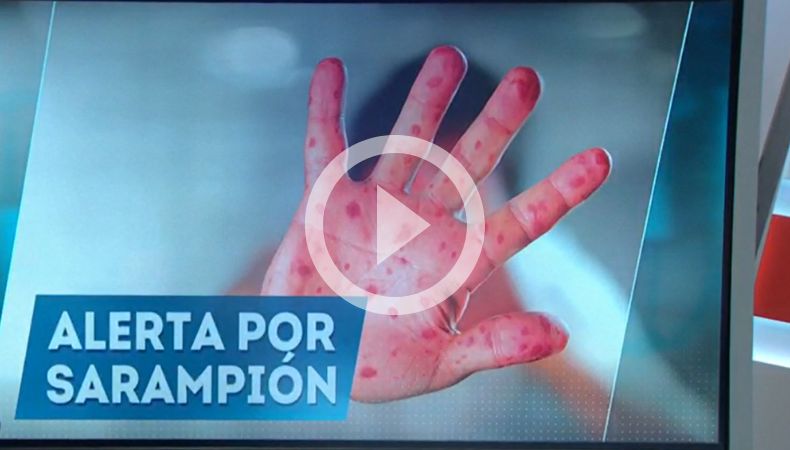 Alerta por sarampión