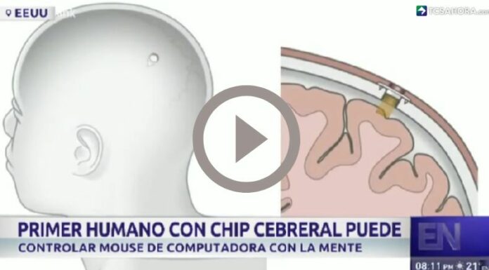 Primer chip cerebral en un ser humano