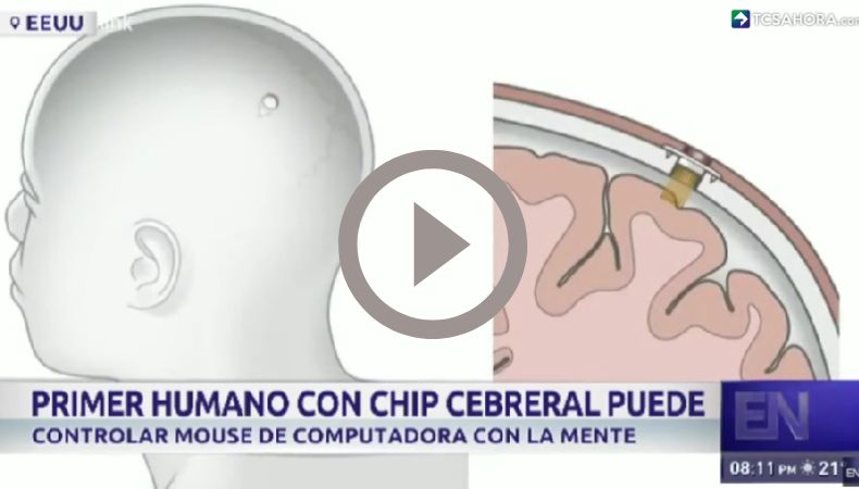 Primer chip cerebral en un ser humano