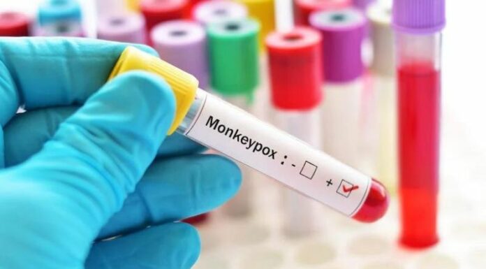 El pasado 14 de agosto, la OMS declaró el Mpox como una emergencia sanitaria internacional.