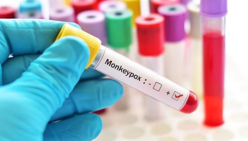 Pakistán confirma el primer caso de Mpox El pasado 14 de agosto, la OMS declaró el Mpox como una emergencia sanitaria internacional.