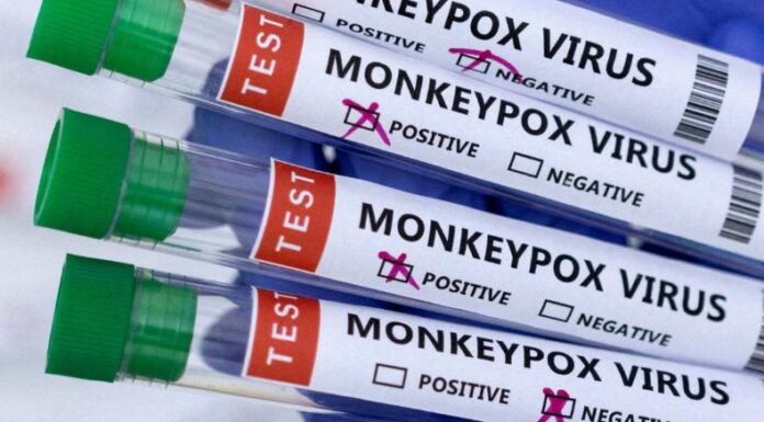 El reporte oficial de las autoridades indican que el caso de mpox ocurrió fuera del país y fue detectado el viernes.