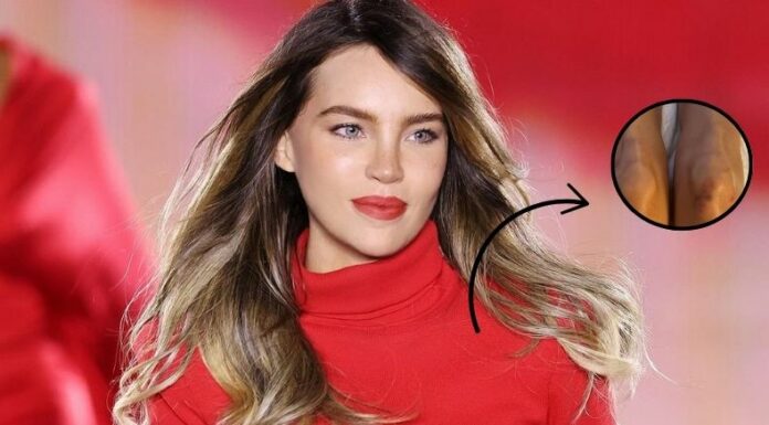 Belinda, quien hace unos días protagonizó tremenda caída, ahora compartió una imagen donde se aprecia que sufrió moretones.