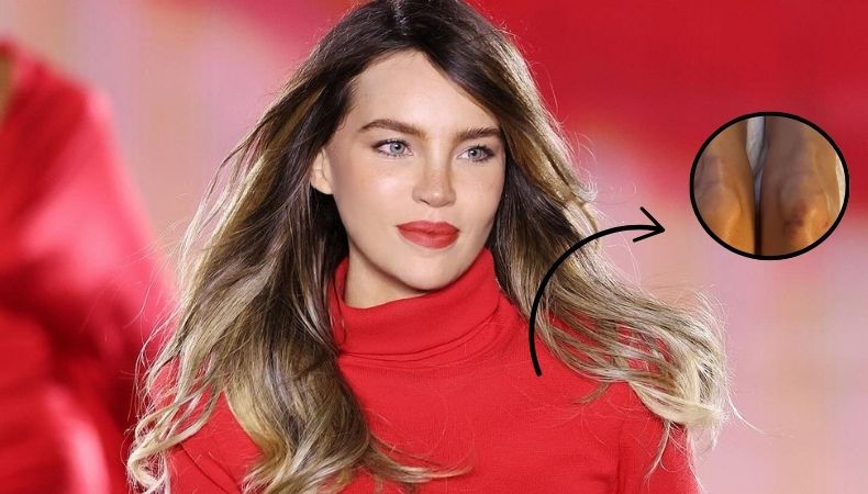 Belinda, quien hace unos días protagonizó tremenda caída, ahora compartió una imagen donde se aprecia que sufrió moretones.