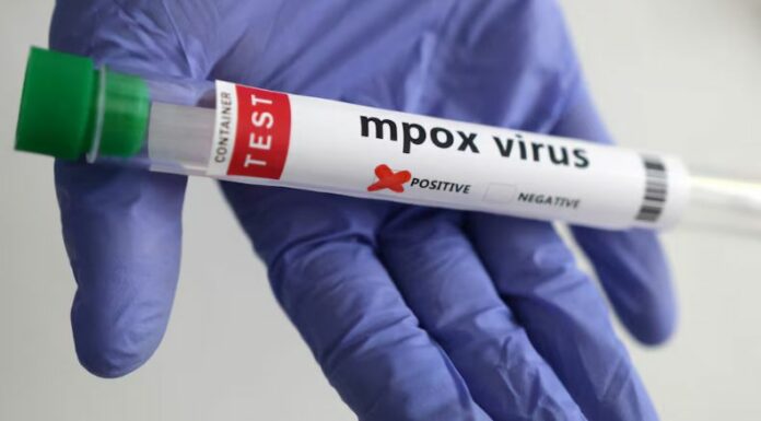 La Organización Mundial de la Salud (OMS) aprobó el uso de un test para el diagnóstico rápido de viruela símica (mpox).