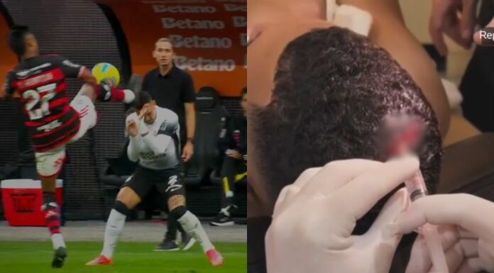 En la disputa de las semifinales de la Copa de Brasil tuvo lugar una agresión desmedida. Imágenes fuertes.