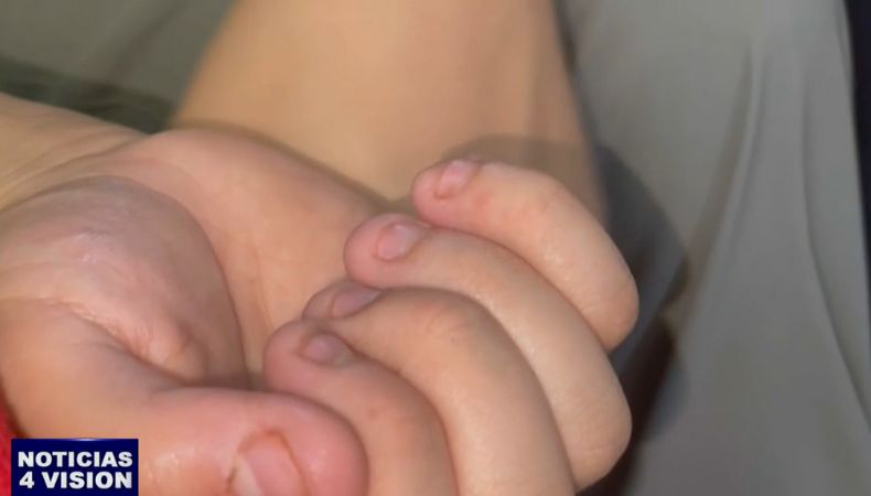 Morderse las uñas es un hábito común que afecta a millones de personas en todo el mundo, el cual puede tener efectos en la salud.