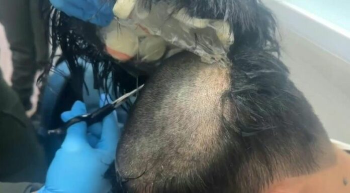 La policía colombiana arrestó a un hombre que portaba más de 400 dosis de cocaína en el aeropuerto de Cartagena.