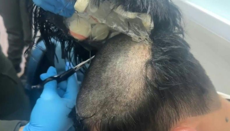 La policía colombiana arrestó a un hombre que portaba más de 400 dosis de cocaína en el aeropuerto de Cartagena.