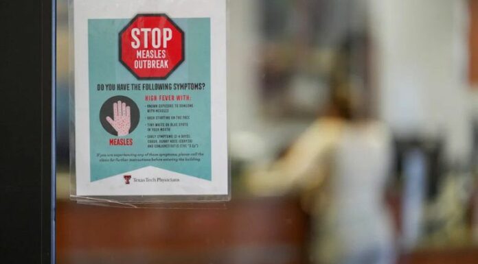El niño, que no había sido vacunado, fue hospitalizado en Lubbock, al noreste de Texas la semana pasada y dio positivo para sarampión.