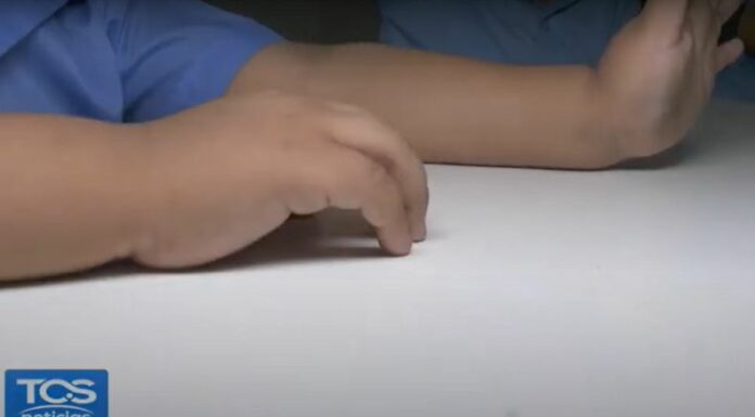 La enfermedad de manos, pies y boca ha generado preocupación entre padres de familia y autoridades educativas debido al aumento de casos.