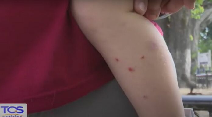 Especialistas recomiendan mantener medidas de prevención para evitar una reinfección del virus manos, pies y boca.