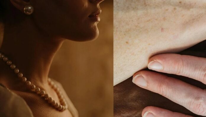 ¿Alergia a las joyas? Conoce qué es la dermatitis por contacto La dermatitis por contacto es una reacción alérgica o irritativa de la piel que ocurre al entrar en contacto con ciertas sustancias como metales, cosméticos o productos químicos.