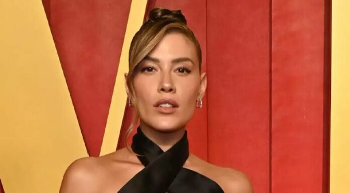 Michelle Salas sorprendió a sus seguidores al revelar que desde hace un par de años batalla con una enfermedad incurable en la piel.