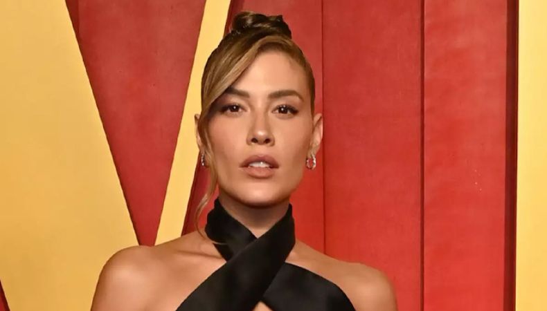 Michelle Salas sorprendió a sus seguidores al revelar que desde hace un par de años batalla con una enfermedad incurable en la piel.