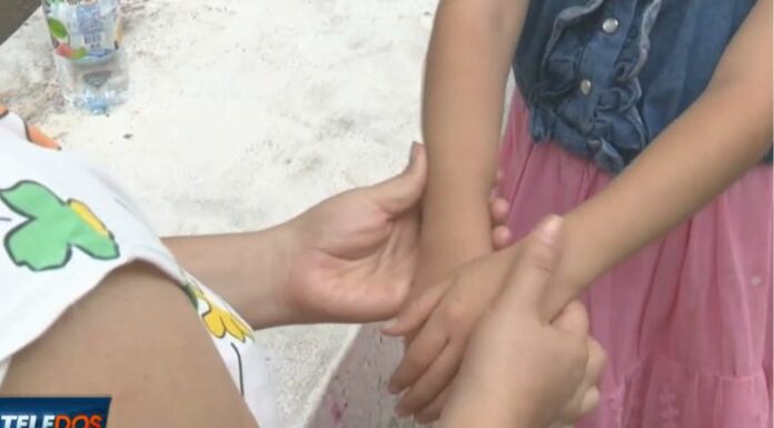 Las enfermedades del sarampión, virus mano, pie y boca y la varicela pueden confundir a los padres de familia debido a sus similitudes.