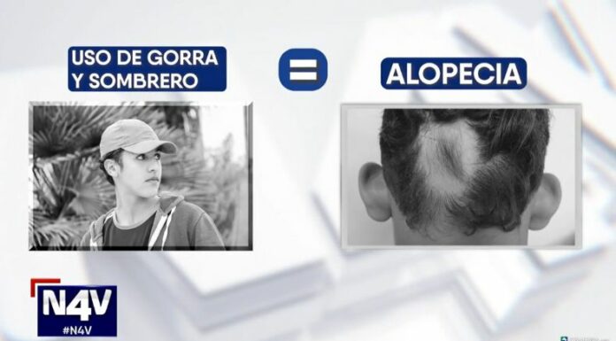 ¿Alguna vez ha escuchado que usar gorras o sombreros provoca alopecia o pérdida de cabello? ¿Qué dicen los expertos al respecto?