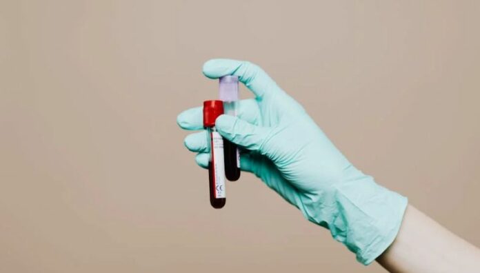 Bancos de sangre se preparan para período vacacional Una donación de sangre podría salvar la vida de hasta tres personas.