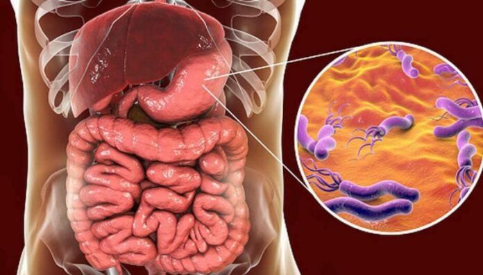 La amenaza silenciosa de la Helicobacter pylori síntomas que no debe ignorar