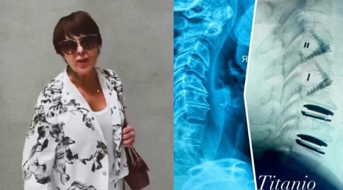 La cantante mexicana se recupera de una intervención en las cervicales y lanzó una broma al asegurar que ahora es “biomecánica”. ¿Por que?