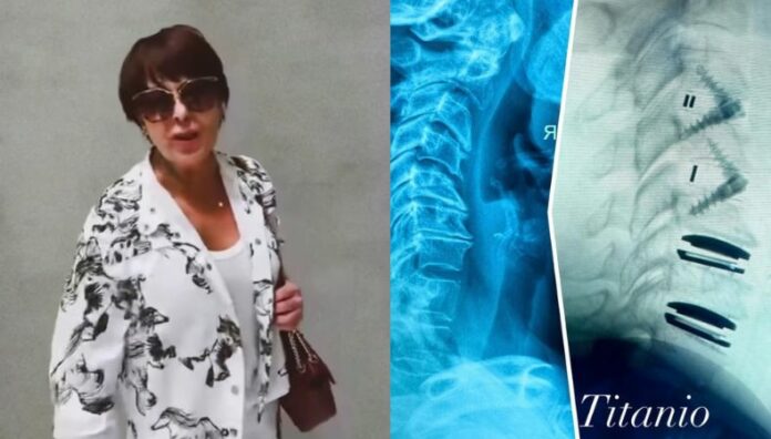 Soy biomecánica Alejandra Guzmán bromea sobre sus operaciones La cantante mexicana se recupera de una intervención en las cervicales y lanzó una broma al asegurar que ahora es “biomecánica”. ¿Por que?