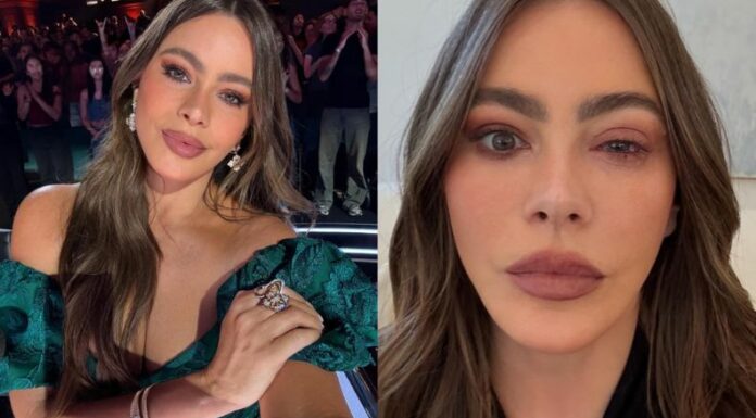 La actriz colombiana sorprendió al revelar por qué no apareció en los Emmy 2025 y mostró imágenes que dejaron claro lo que le pasó horas antes de la gala.