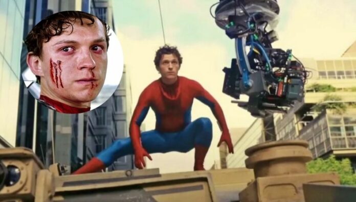 ¡Hospitalizado de emergencia! Tom Holland sufre accidente en rodaje de Spider-Man 4 El actor de la cuarta entrega de Spider-Man, Tom Holland, sufrió un accidente durante una escena de riesgo y fue hospitalizado de emergencia. ¿Qué se sabe realmente de su estado?