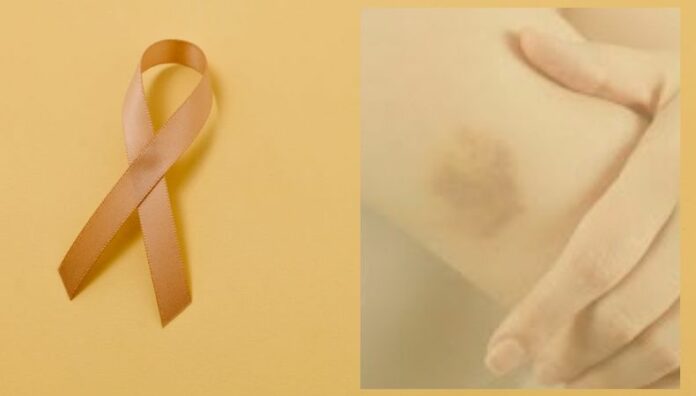 Leucemia crónica: cómo enfrentarla con medicina y hábitos saludables La leucemia crónica es un tipo de cáncer de la sangre y la médula ósea que se desarrolla de manera lenta y progresiva. Aunque no tiene cura definitiva, existen tratamientos que permiten controlarla.