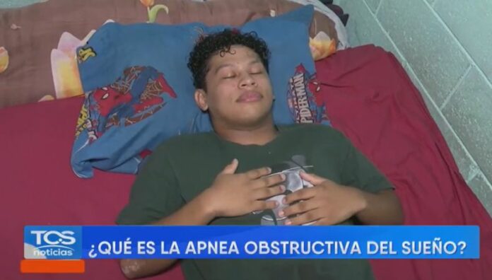 ¿Cómo identificar los signos de la apnea obstructiva del sueño? Un ronquido intenso y cansancio constante podrían revelar un trastorno que compromete la salud integral: la apnea del sueño.