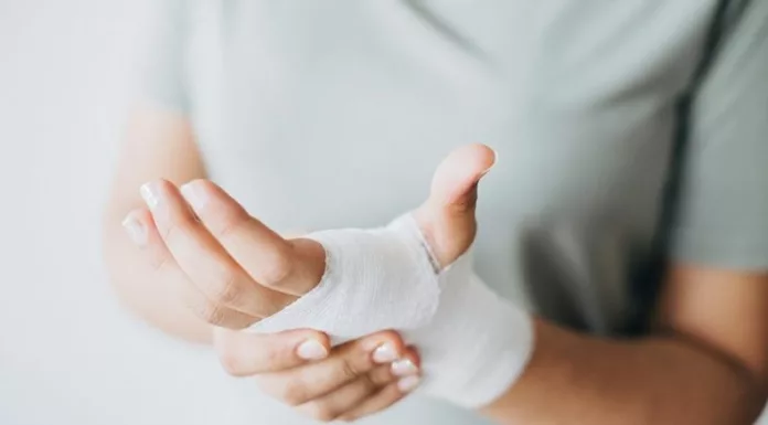 Entre las principales causas de quemaduras está la de contacto con objetos o sustancias calientes y por exposición directa al fuego.