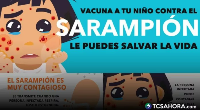 El sarampión es la enfermedad infecciosa más contagiosa de todas. OPS y médicos, llaman a reforzar la vacunación contra esta afección vírica.