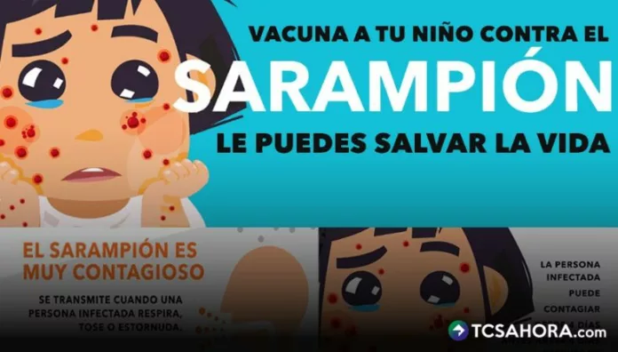 El sarampión es la enfermedad infecciosa más contagiosa de todas. OPS y médicos, llaman a reforzar la vacunación contra esta afección vírica.
