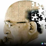 Más de 80 mil salvadoreños podrán tener Alzheimer en 2030