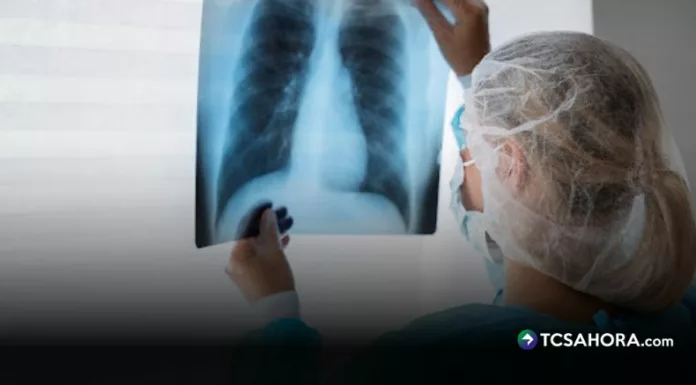 Aunque los informes recientes muestran una leve disminución, la neumonía suma 1,200 casos y sigue bajo observación de las autoridades de Salud.