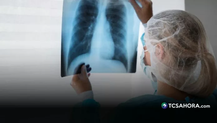 Aunque los informes recientes muestran una leve disminución, la neumonía suma 1,200 casos y sigue bajo observación de las autoridades de Salud.