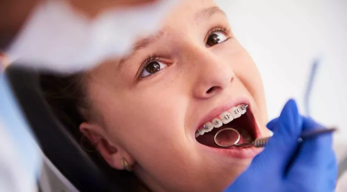 Los brackets ayudan a corregir la posición de los dientes y mejorar la sonrisa, pero muchas personas aún se preguntan cuál es la edad ideal para iniciar este tratamiento.