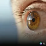 «Un hipertenso estaría más propenso a tener glaucoma»: Dr. Somoza