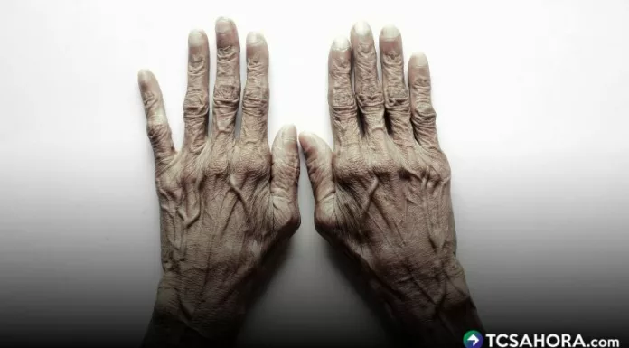 Hay manifestaciones motoras principales de esta enfermedad neurodegenerativa. Mañana se conmemora su día y busca concienciar y visibilizar.