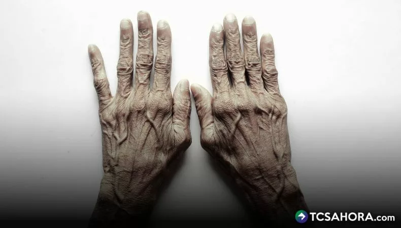 Parkinson: signos y síntomas cardinales de la enfermedad