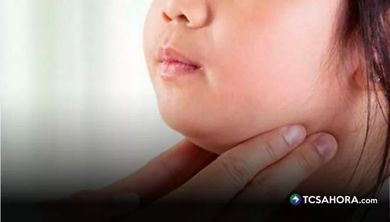 Bùng phát bệnh quai bị tại El Salvador