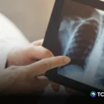 Registran más de 2 mil casos de neumonía en El Salvador