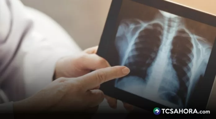 La neumonía es una enfermedad prevenible, por lo que recomiendan estar atentos a los signos de alerta para evitar que las cifras aumenten.