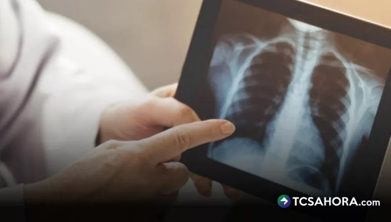 Cảnh báo viêm phổi tại El Salvador