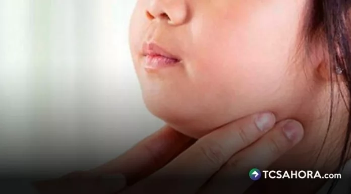 La parotiditis infecciosa, conocida popularmente como paperas, afecta principalmente a niños y adolescentes.