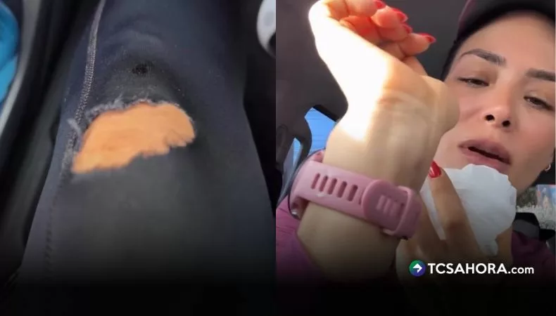 La conductora de "Liberadas" mostró el fuerte golpe que sufrió mientras corría. Terminó con heridas en el rostro, manos y piernas.