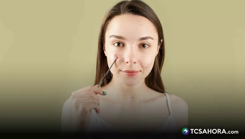 Acné en adultos: ¿Por qué aparece y cómo prevenirlo?